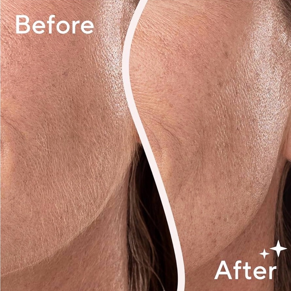 Finishing Touch Flawless Dermaplane Glo Sonic with 6 Replacement Blades - New - Picture 11 of 11